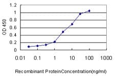 IHC-plus™ XRCC6 / Ku70 Antibody (clone 4C2-1A6)