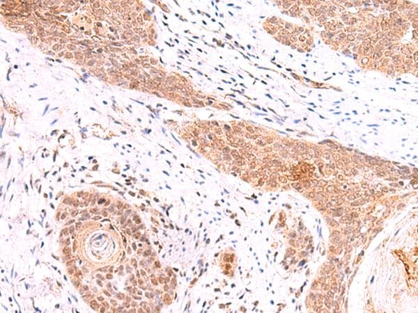 COPS3 / CSN3 Antibody
