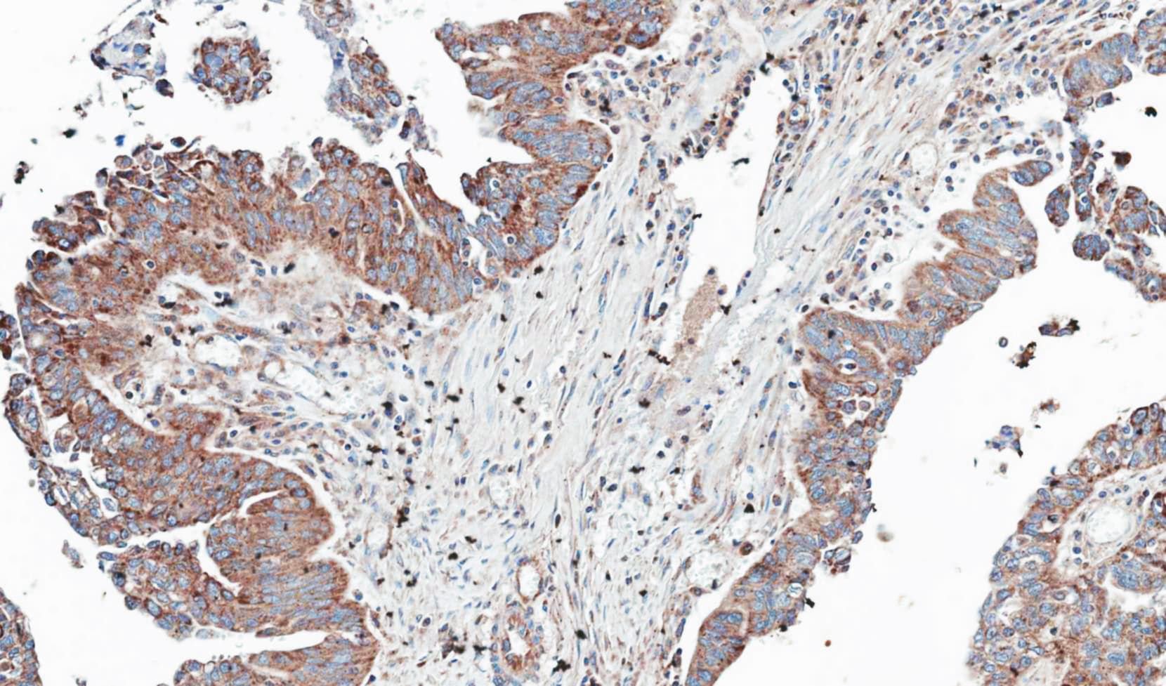 NT5C2 Antibody (aa108-362)