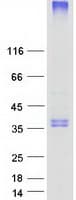 Human FVT1 / KDSR Protein (Recombinant Myc-DDK (Flag))