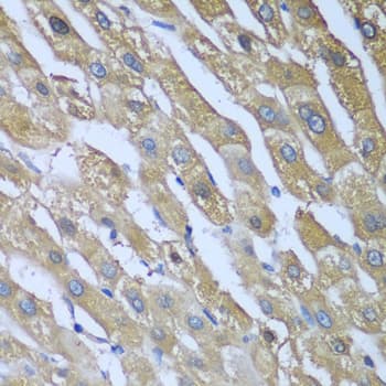 Polyclonal Rabbit anti-Human CAD Antibody (IHC, WB)