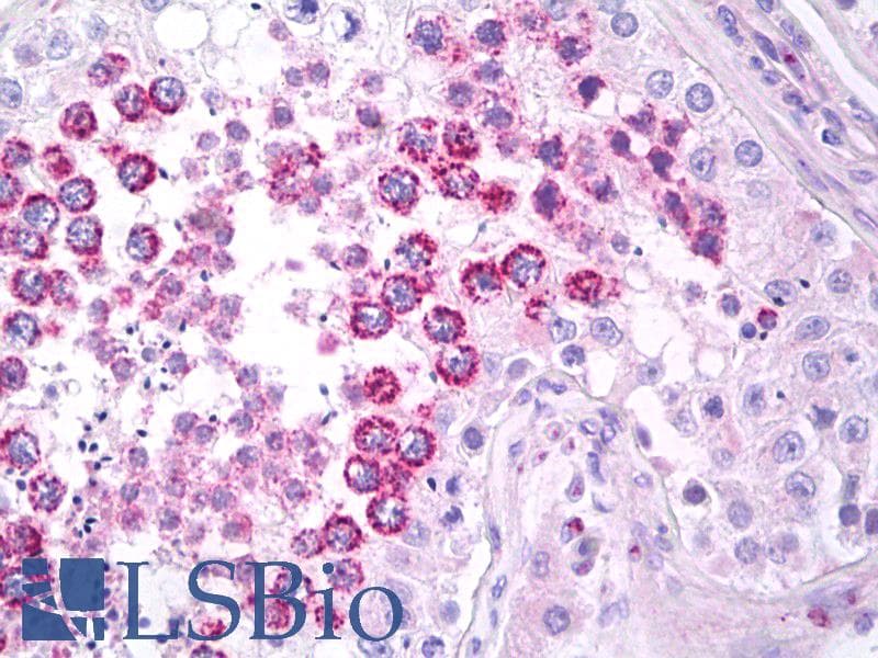 IHC-plus™ PIG8 / EI24 Antibody