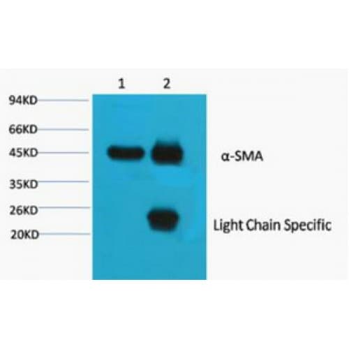 ACTA1 / Skeletal Muscle Actin Antibody (Internal, clone 4B11)