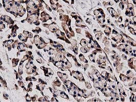 HDAC6 Antibody (clone OTI3E7)