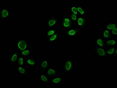 Polyclonal Rabbit anti-Human HIST1H2BN Antibody (IHC, IF, WB)