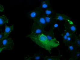 KLK8 / Kallikrein 8 Antibody (clone OTI10D3)