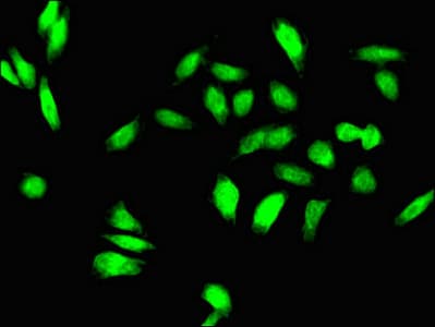Polyclonal Rabbit anti-Human TGIF1 Antibody (IHC, IF, WB)