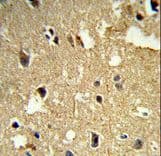 TUBB1 / Tubulin Beta 1 Antibody