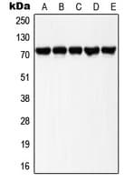 LIMK1 + LIMK2 Antibody (phospho-Thr508/Thr505)