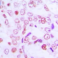 CCNG1 / Cyclin G1 Antibody (Internal)