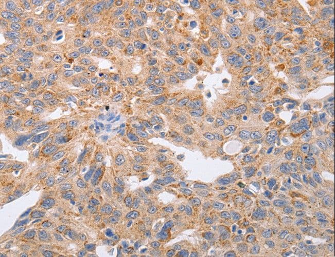 PPP1CB Antibody