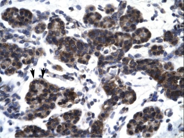 SMAD3 Antibody (N-Terminus)