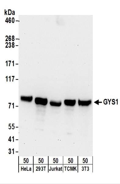 GYS1 / Glycogen Synthase Antibody (aa625-675)