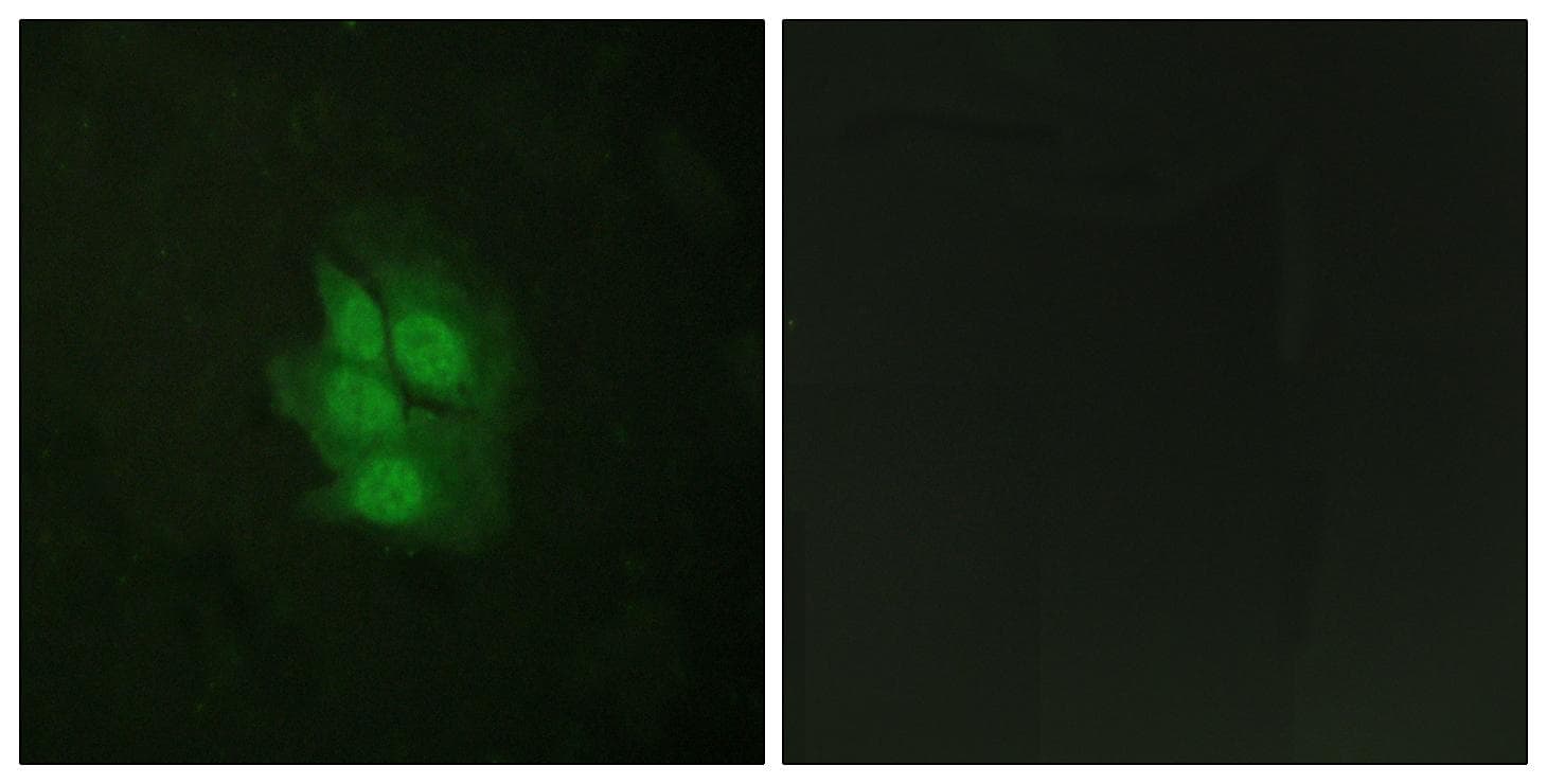 TP53 / p53 Antibody (phospho-Ser392)