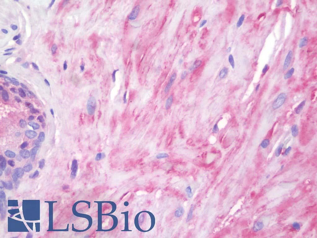 IHC-plus™ VCL / Vinculin Antibody (aa356-607)