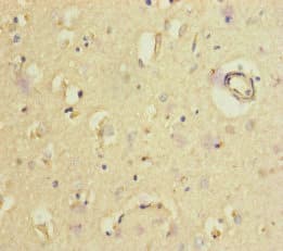 GORASP2 / GRASP55 Antibody