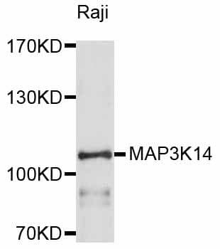 Polyclonal Rabbit anti-Human MAP3K14 Antibody (WB)
