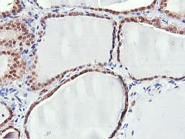 Monoclonal Mouse anti-Human PNPO Antibody (clone OTI1H9, IHC, WB)