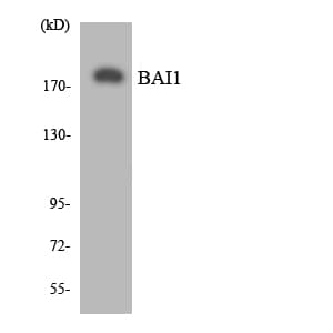 IHC-plus™ ADGRB1 / BAI1 Antibody (aa683-732)