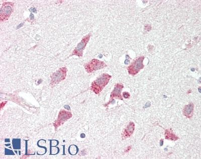 IHC-plus™ HUNK / B19 Antibody (aa238-287)