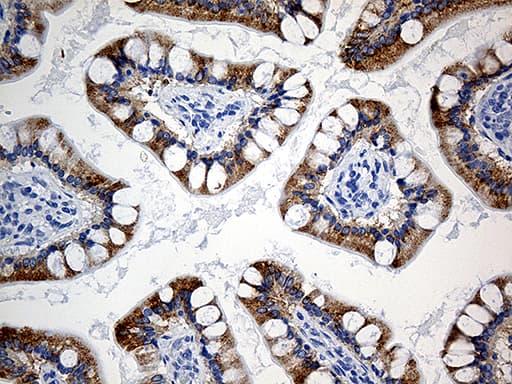 ACS5 / ACSL5 Antibody (aa104-620, clone OTI3A3)
