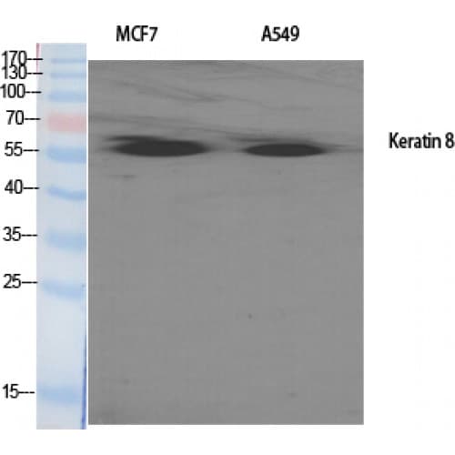 KRT8 / CK8 / Cytokeratin 8 Antibody (370-450 aa)