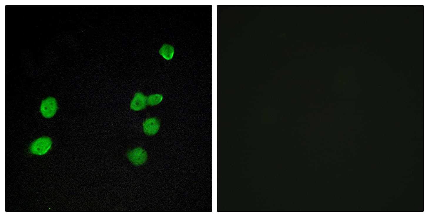 IHC-plus™ Polyclonal Rabbit anti-Human MAPK6 / ERK3 Antibody (aa461-510, IHC, IF, WB)