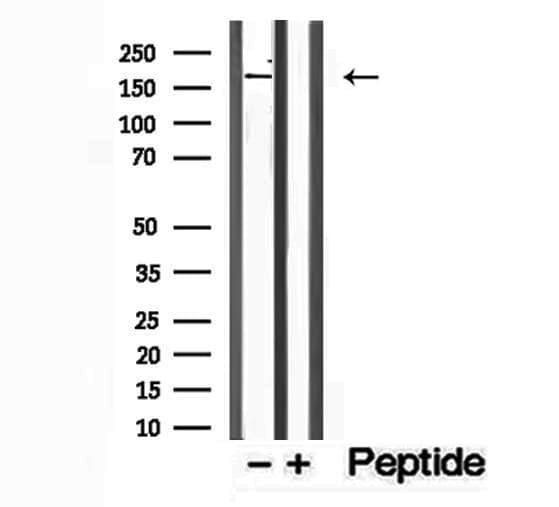 Polyclonal Rabbit anti-Human PTPN23 / HDPTP Antibody (IHC, IF, WB)