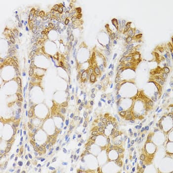 MYO5A / Myosin V Antibody