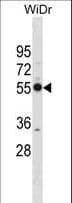 Polyclonal Rabbit anti-Human PSMD12 / Rpn5 Antibody (aa276-304, WB)