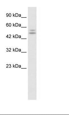 P2RX2 / P2X2 Antibody (aa55-104)
