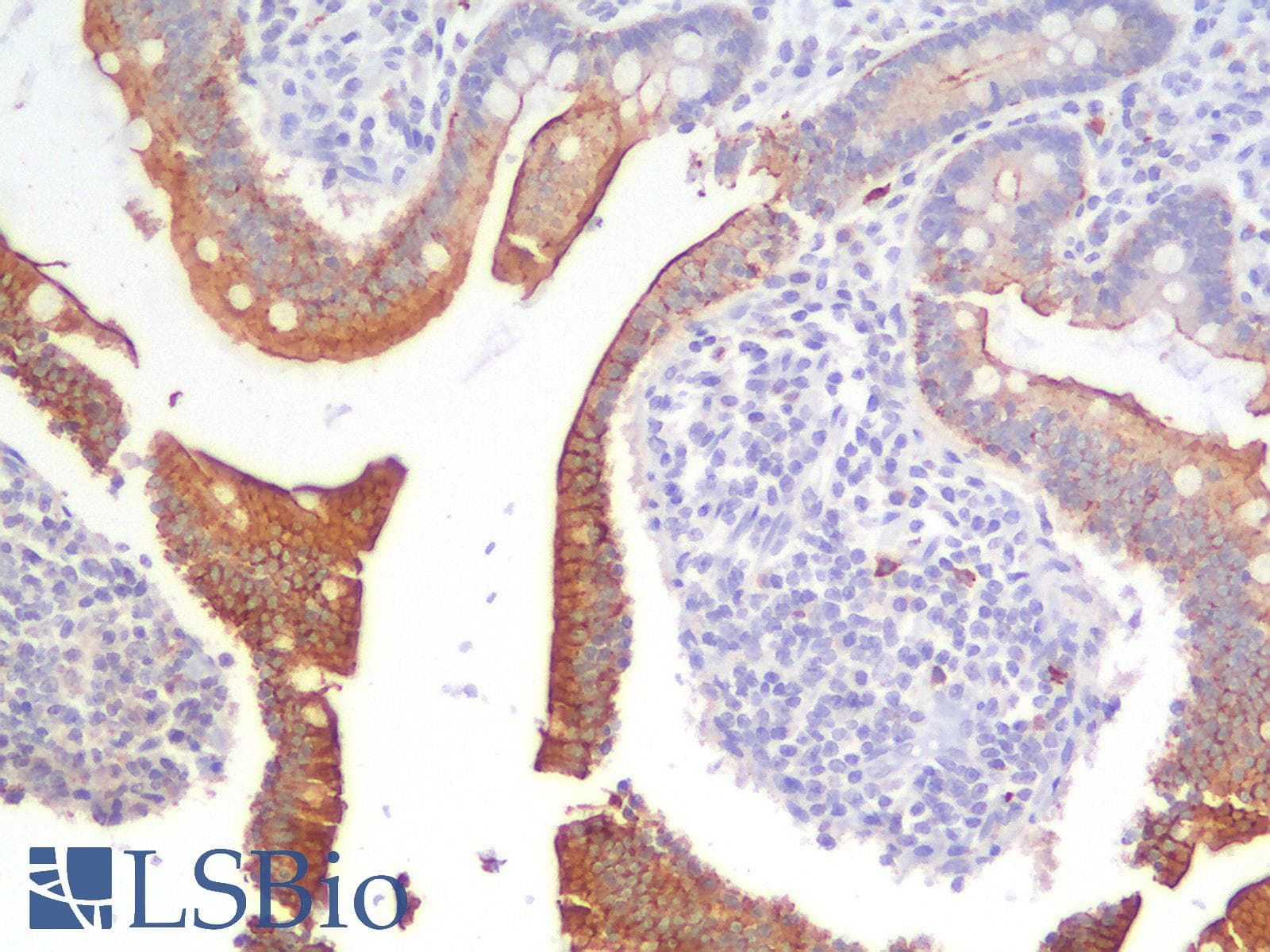 PathPlus™ AMACR / P504S Antibody (aa 297-394, clone AMACR/2748R)