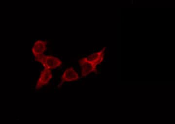DNAJC5 / CSP Antibody