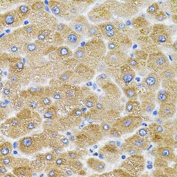 Polyclonal Rabbit anti-Mouse Mitofusin 2 / MFN2 Antibody (IHC, WB)
