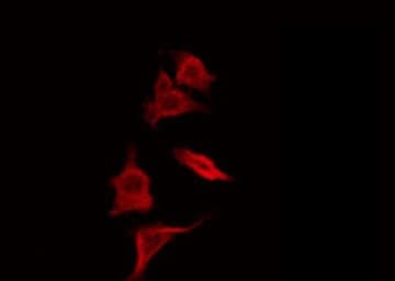 SCGB2A1 / Mammaglobin B Antibody