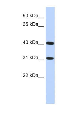 Polyclonal Rabbit anti-Human FAM46D Antibody (C-Terminus, WB)