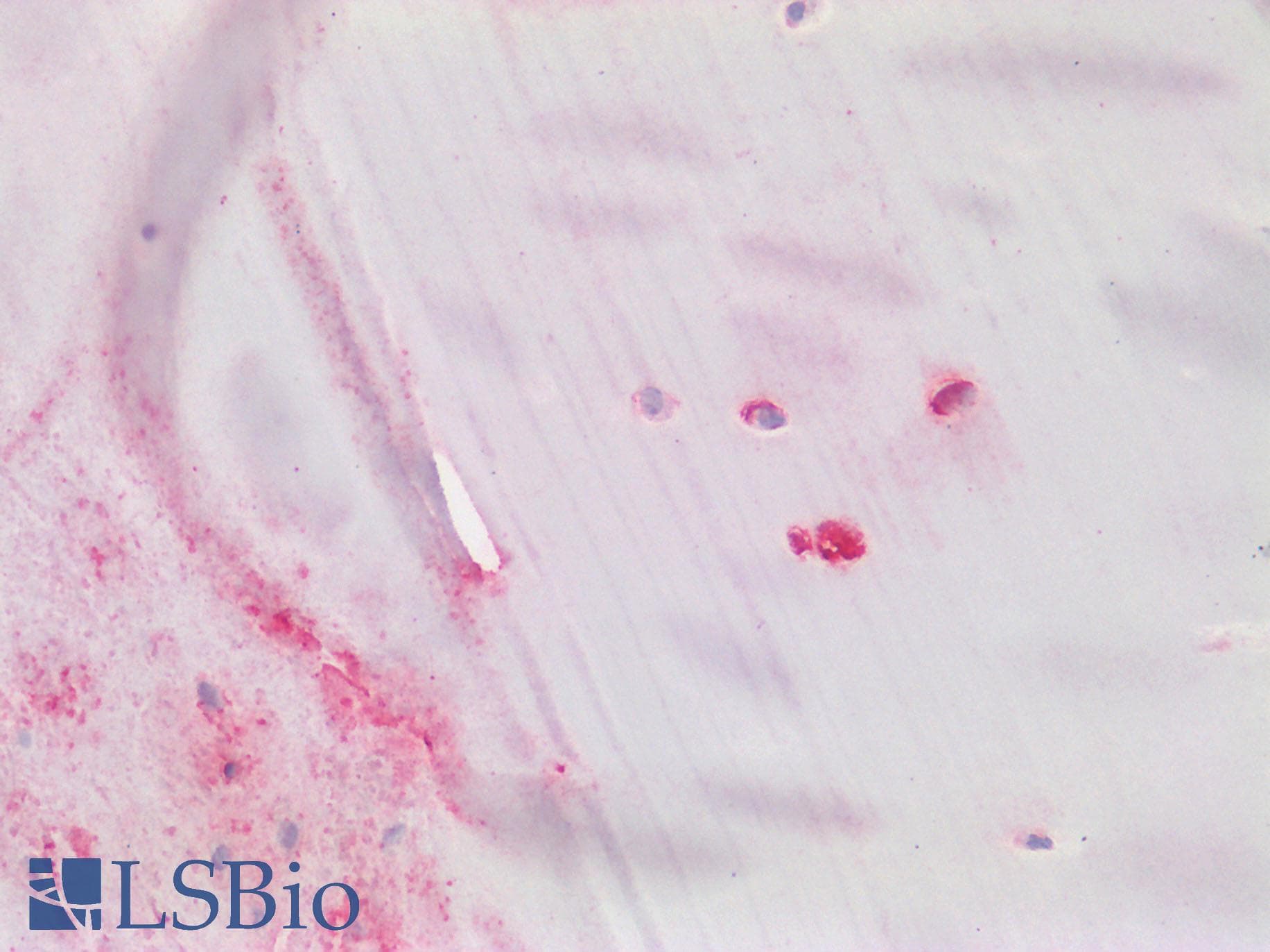 IHC-plus™ Polyclonal Rabbit anti-Human ACAN / Aggrecan Antibody (Internal, IHC)