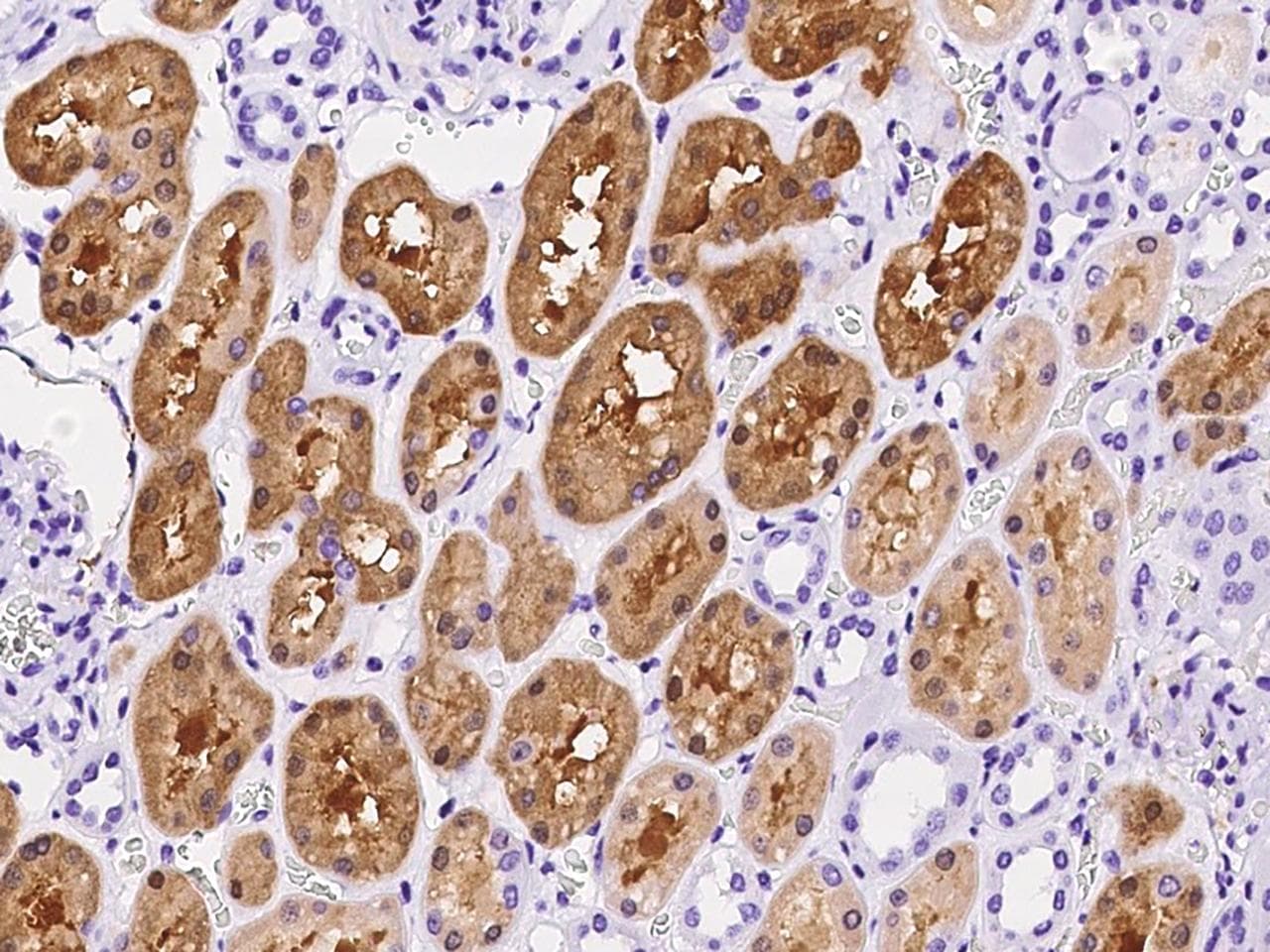 Polyclonal Rabbit anti-Human PSAT1 Antibody (IHC, WB)