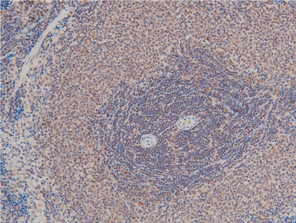 LIMK1 / LIMK Antibody (phospho-Thr508)