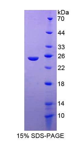 Human FNBP1 / FBP17 Protein (Recombinant His-T7)