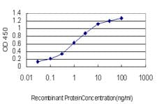 GOLGB1 / Giantin Antibody (clone 6D4)
