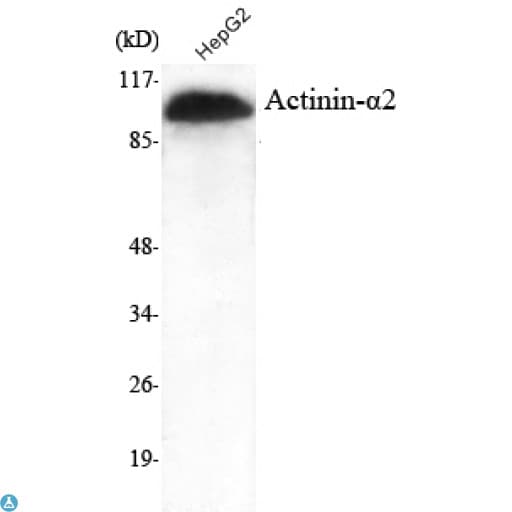 ACTN2 Antibody