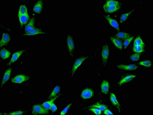 Polyclonal Rabbit anti-Human SENP1 Antibody (IHC, IF, WB)