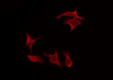 Polyclonal Rabbit anti-Human FCRL5 / CD307 Antibody (IF, WB)