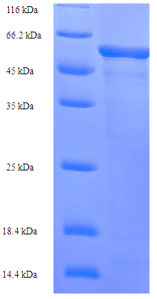 Human L2HGDH Protein (Recombinant His)