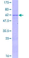 Human ZNF324 / ZF5128 Protein (Recombinant GST)