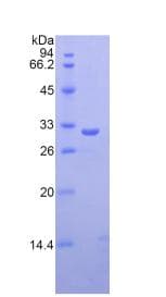Human FCN3 / Ficolin-3 Protein (Recombinant His, N-Terminal)