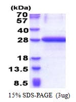 Human NABP1 / OBFC2A Protein (Recombinant His)