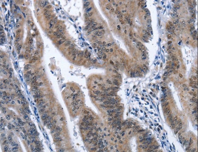 NECL-1 / CADM3 Antibody