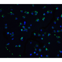 IHC-plus™ DAPK3 / ZIP Kinase Antibody